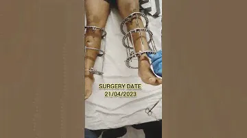 Height Increase Surgery | Surgery For Height | Limb Lengthening Surgery In Delhi